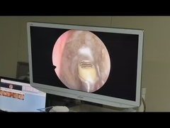 Thiết bị phẫu thuật Máy phát plasma tần số cao tần số vô tuyến