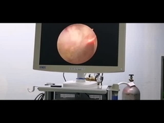 Hệ thống phẫu thuật RF Plasma Điện cực tiết niệu cho tăng sản tuyến tiền liệt lành tính